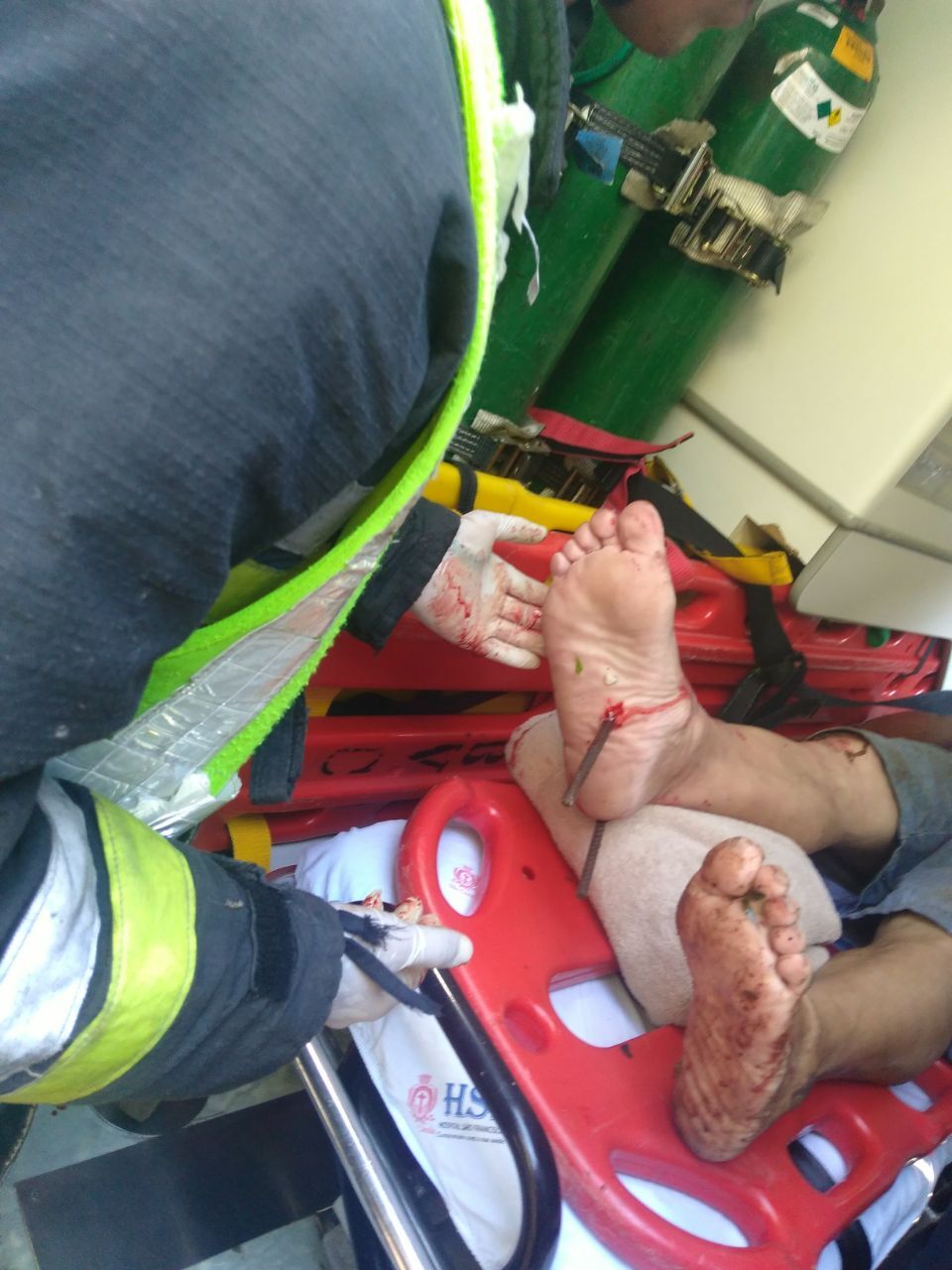Homem cai de caixa d`água e tem ferimentos graves em um dos pés